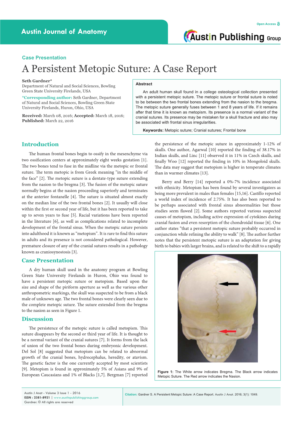 A Persistent Metopic Suture: a Case Report