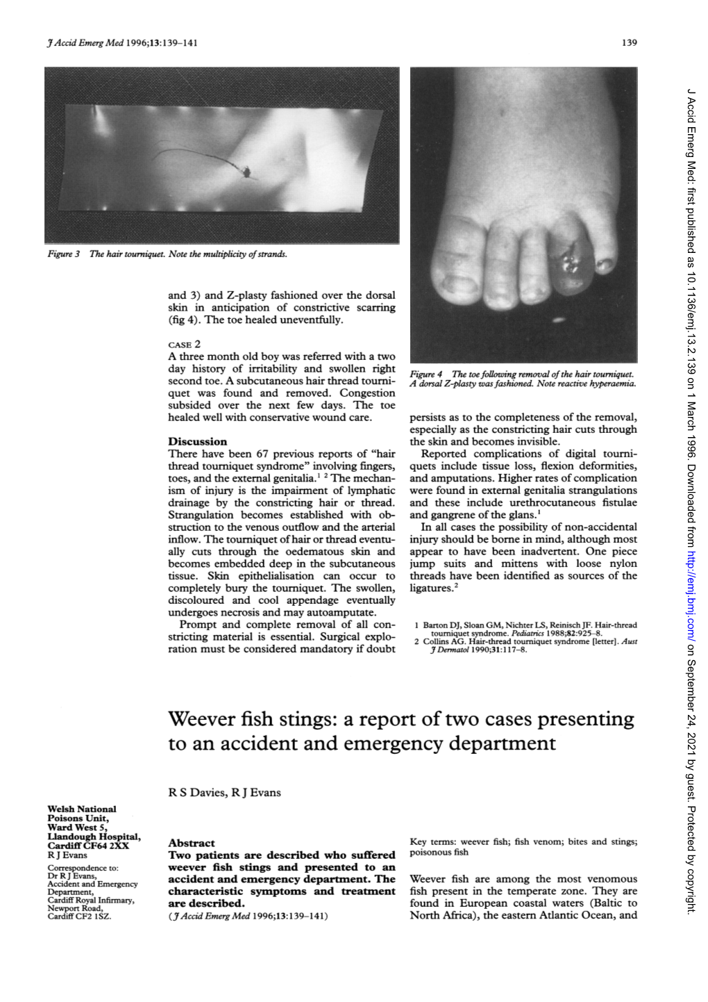 Weever Fish Stings: a Report of Two Cases Presenting to an Accident and Emergency Department