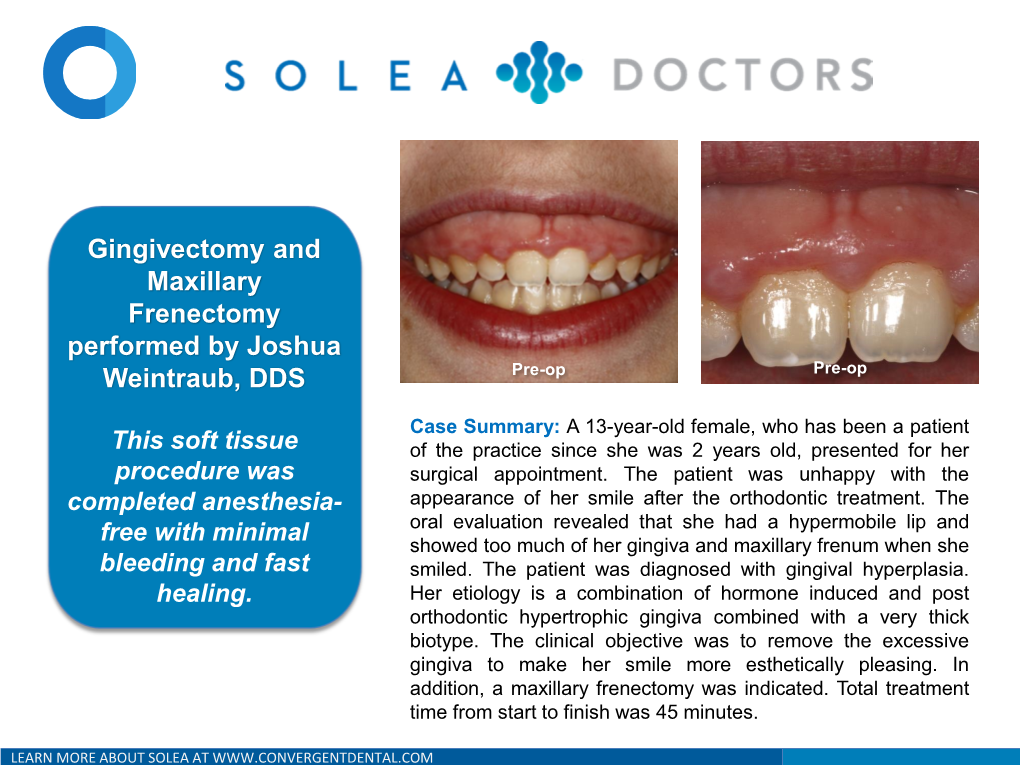 Gingivectomy and Maxillary Frenectomy Performed by Joshua Weintraub, DDS Pre-Op Pre-Op