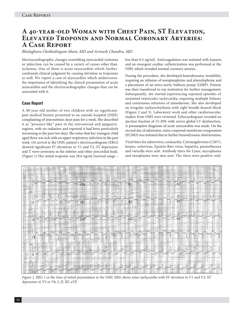 A 40-Year-Old Woman with Chest Pain, ST Elevation, Elevated