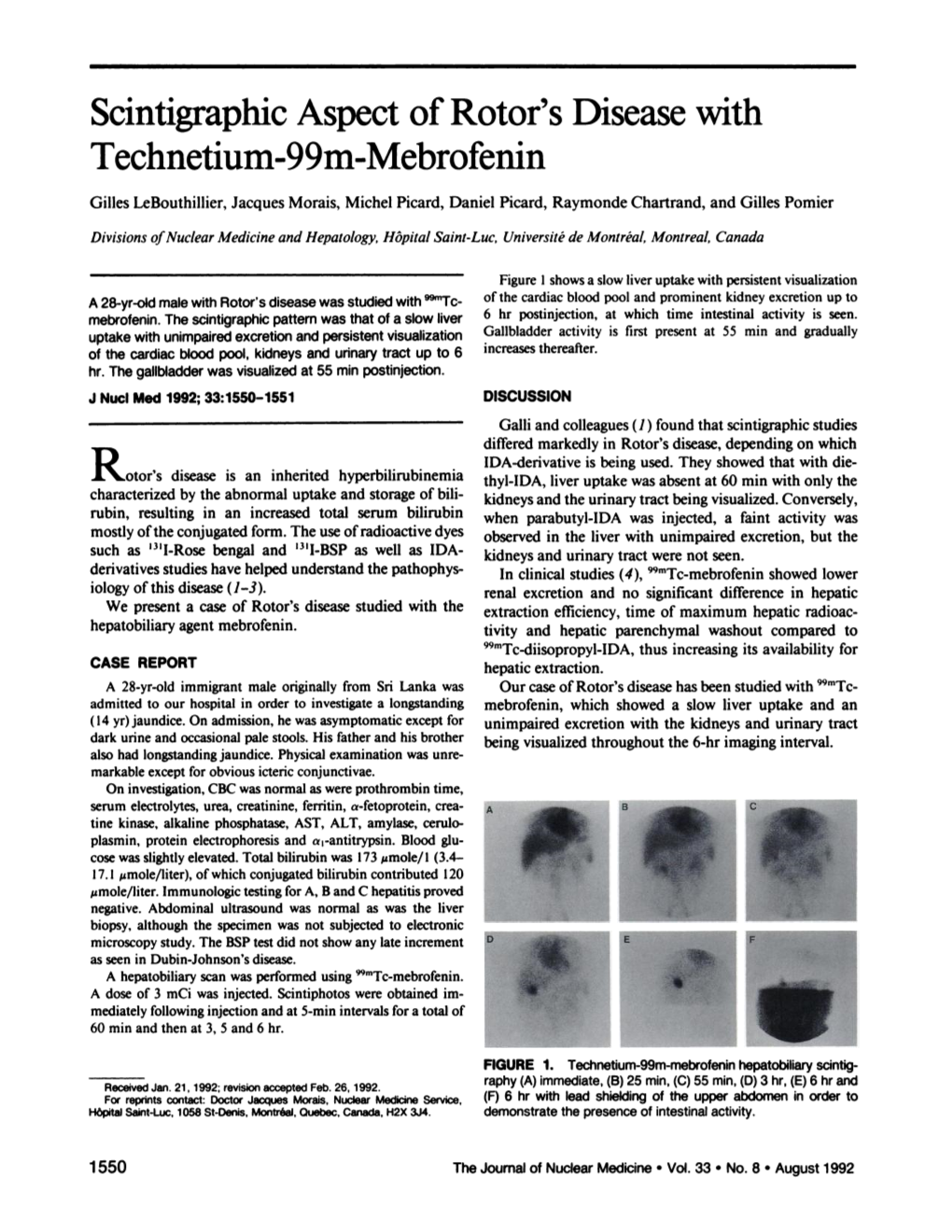 Scintigraphicaspect of Rotor's Disease with Technetium-99M-.Mebrofemn