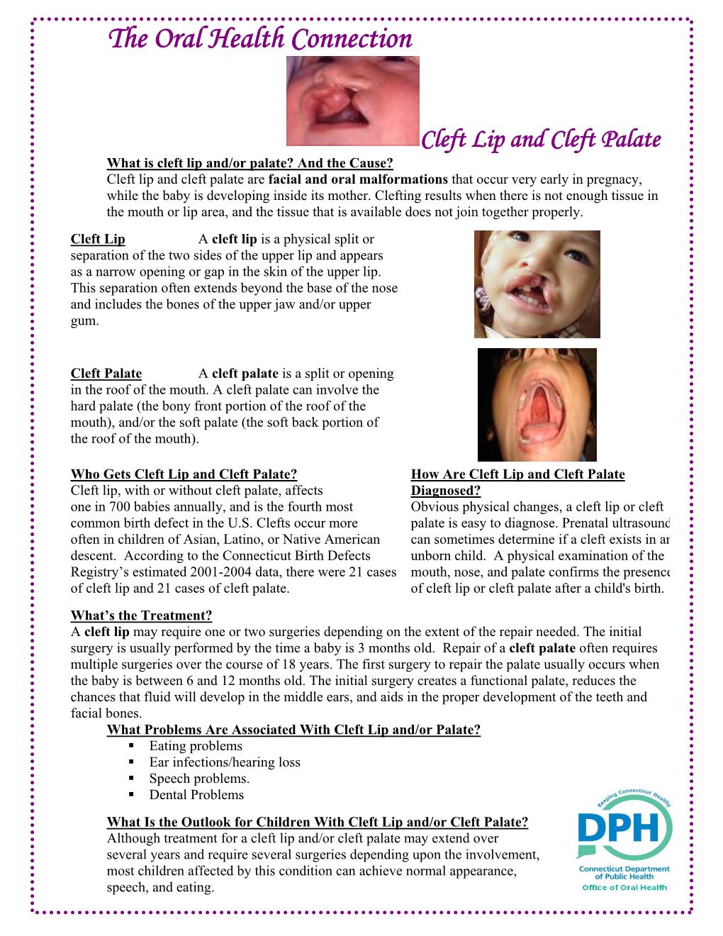 The Oral Health Connection Cleft Lip and Cleft Palate