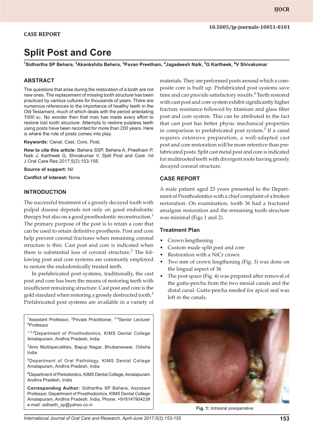 Split Post and Core Case Report