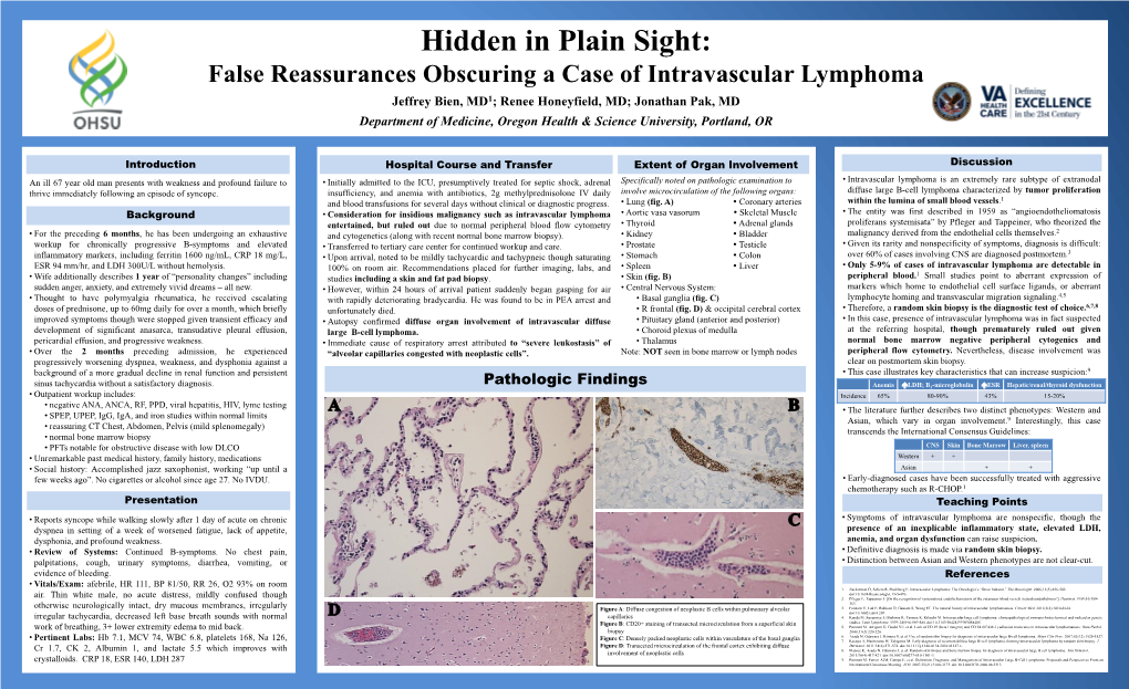 False Reassurances Obscuring a Case of Intravascular Lymphoma