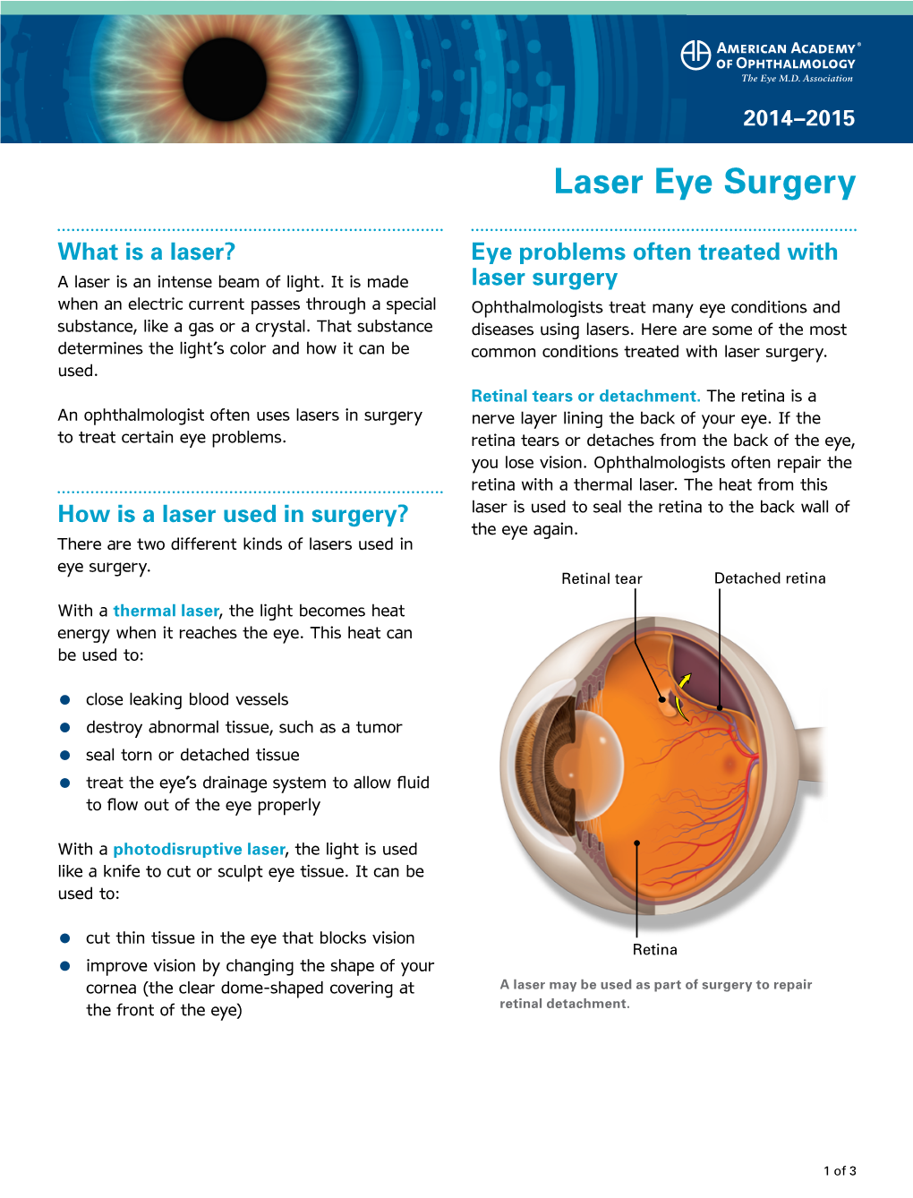 Laser Eye Surgery