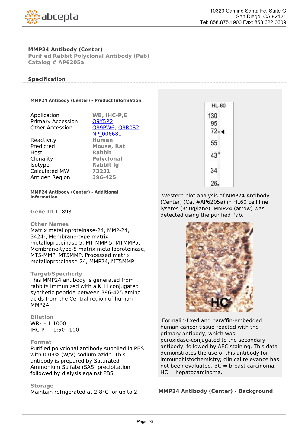 MMP24 Antibody (Center) Purified Rabbit Polyclonal Antibody (Pab) Catalog # Ap6205a