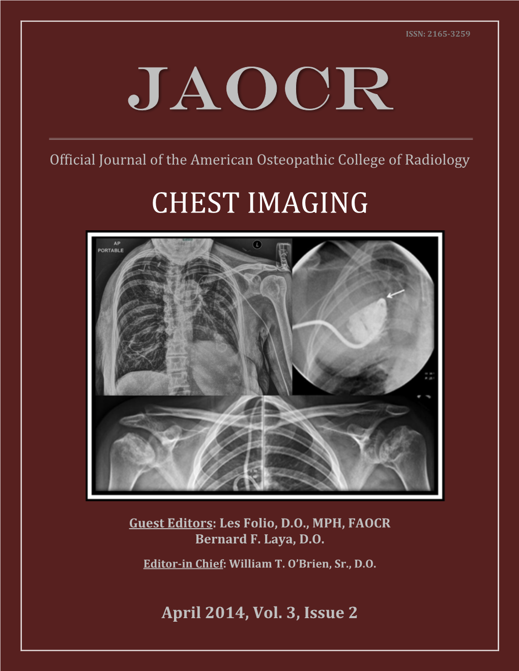 Chest Imaging