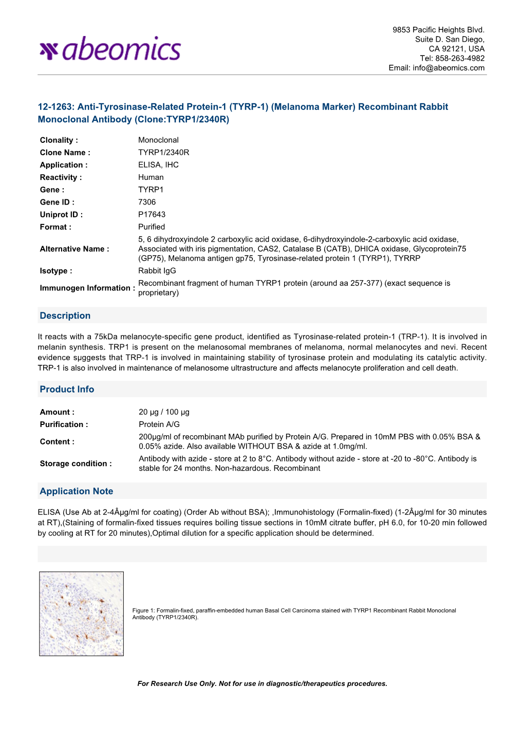 Recombinant Rabbit Monoclonal Antibody (Clone:TYRP1/2340R)