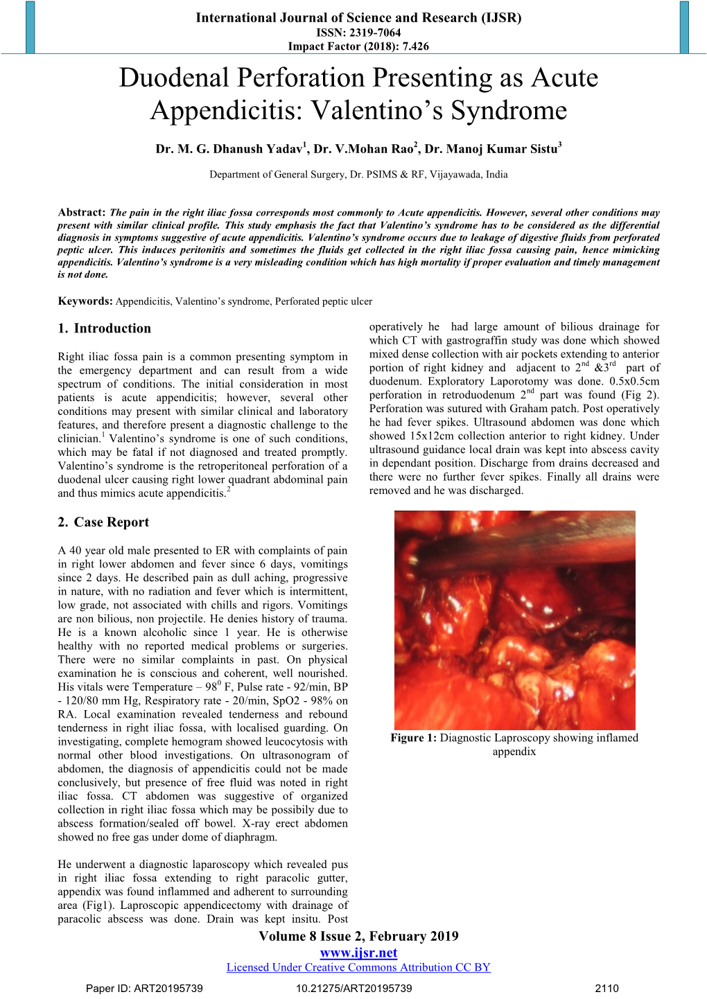 Duodenal Perforation Presenting As Acute Appendicitis: Valentino's