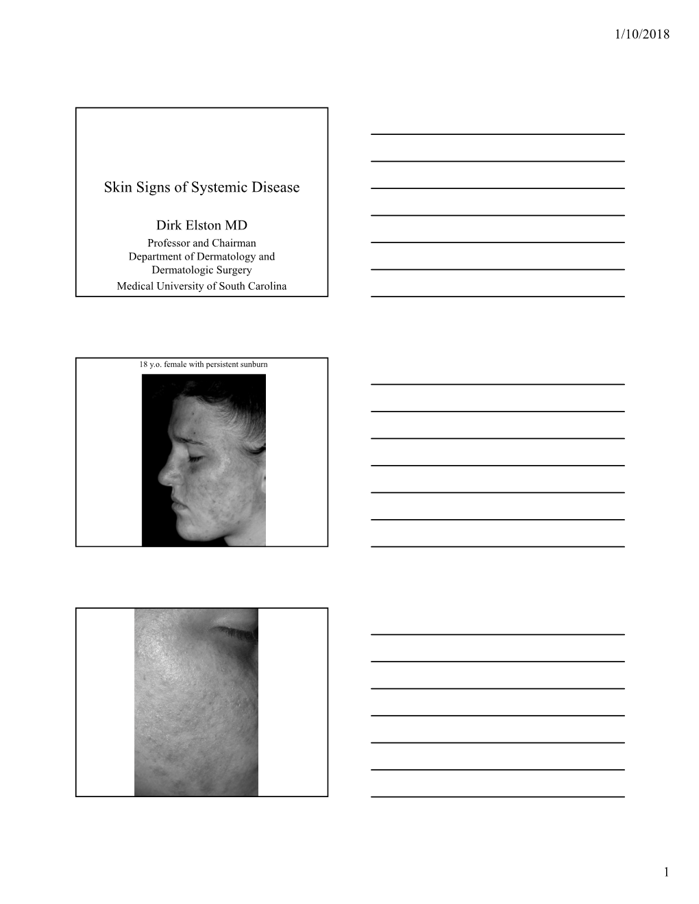 Skin Signs of Systemic Disease