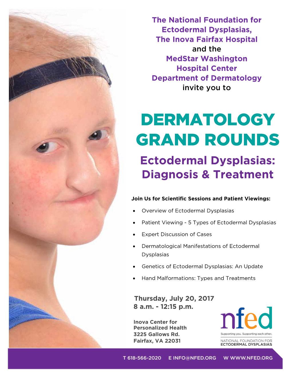 DERMATOLOGY GRAND ROUNDS Ectodermal Dysplasias: Diagnosis & Treatment