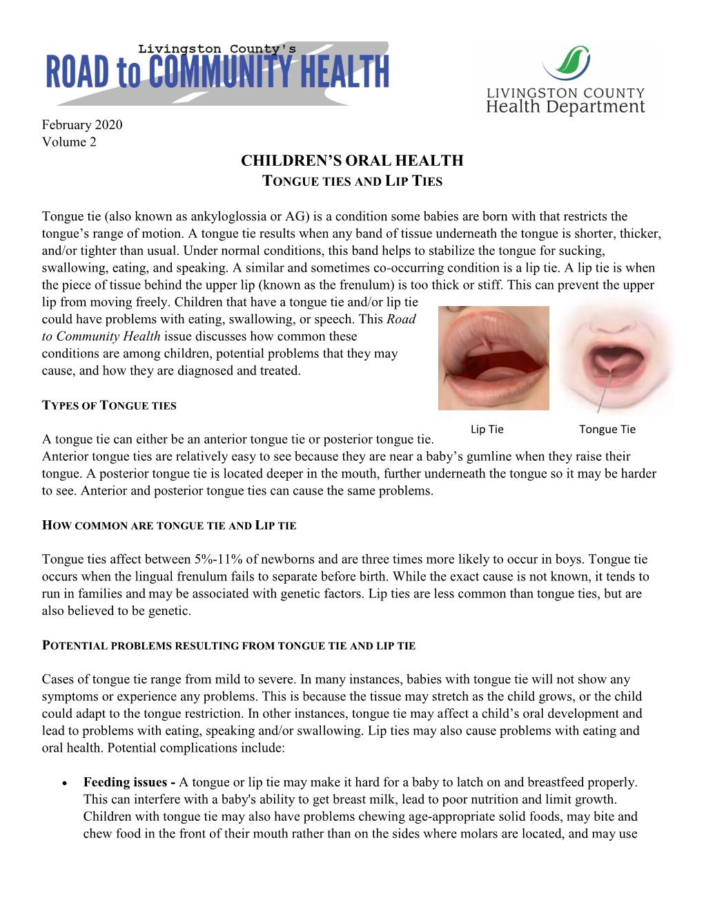 Children's Oral Health Tongue Ties and Lip Ties