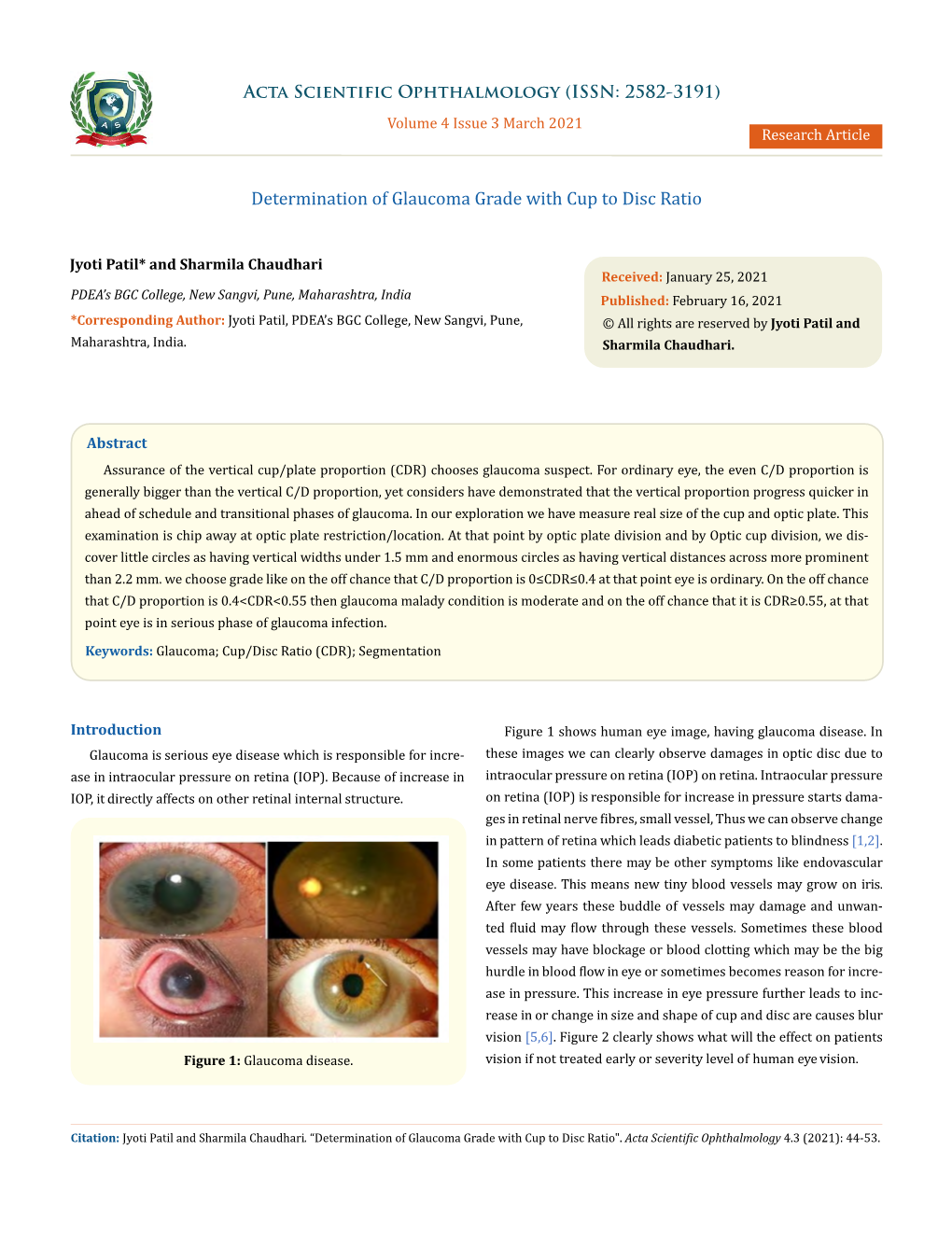 Determination of Glaucoma Grade with Cup to Disc Ratio