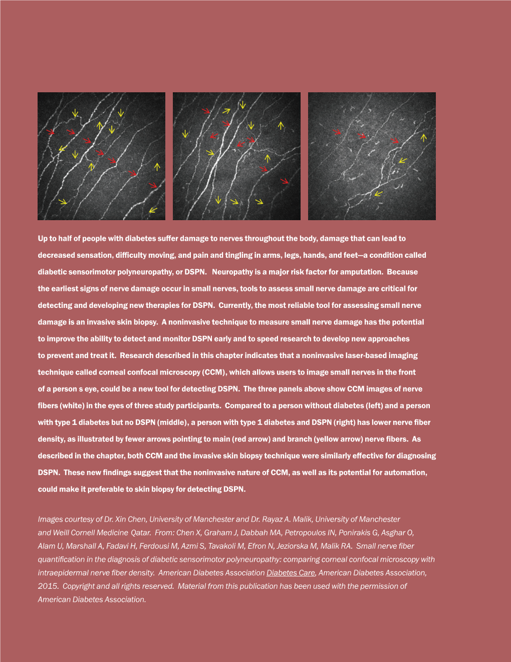 NIDDK Recent Advances and Emerging Opportunities