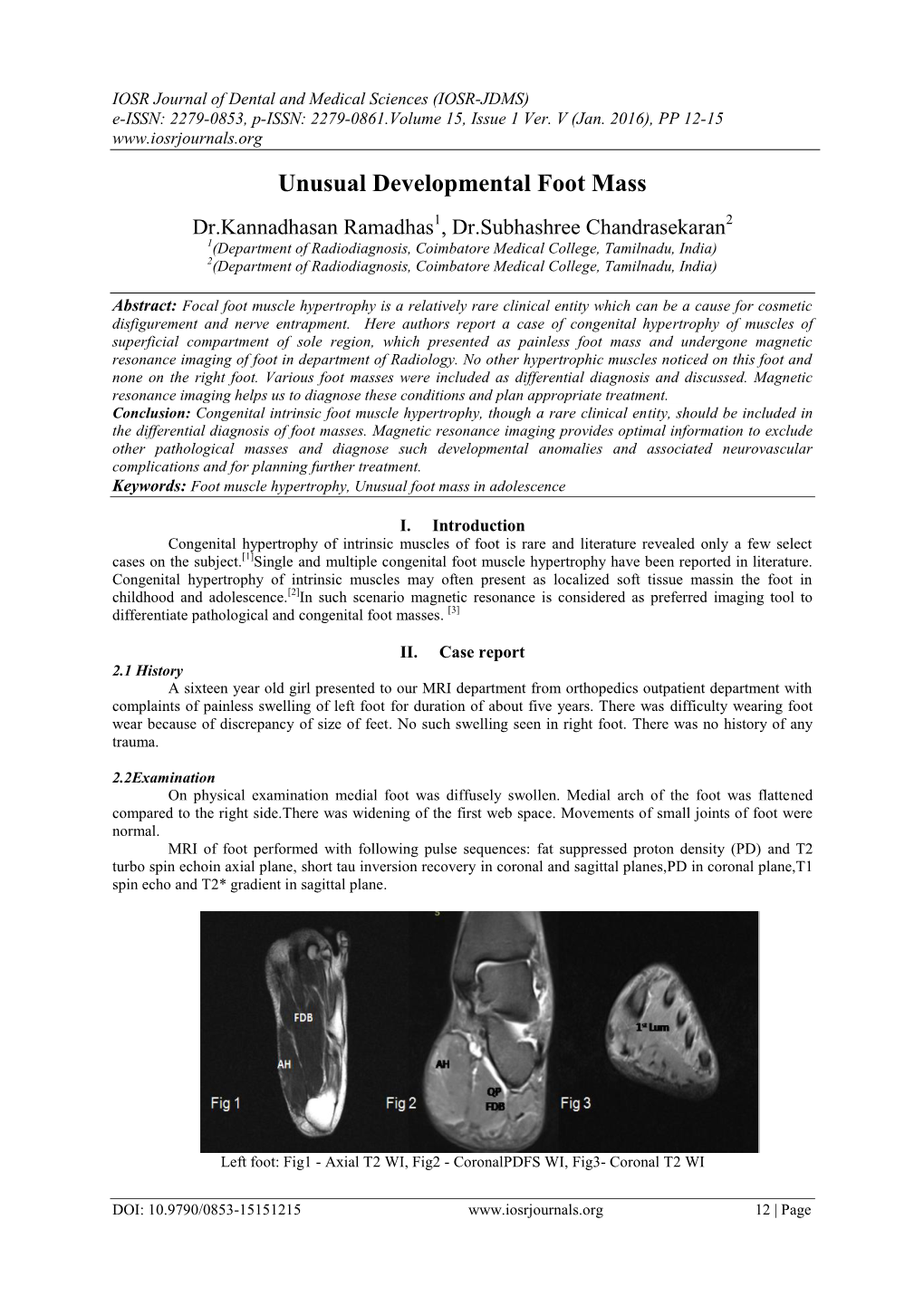 Unusual Developmental Foot Mass