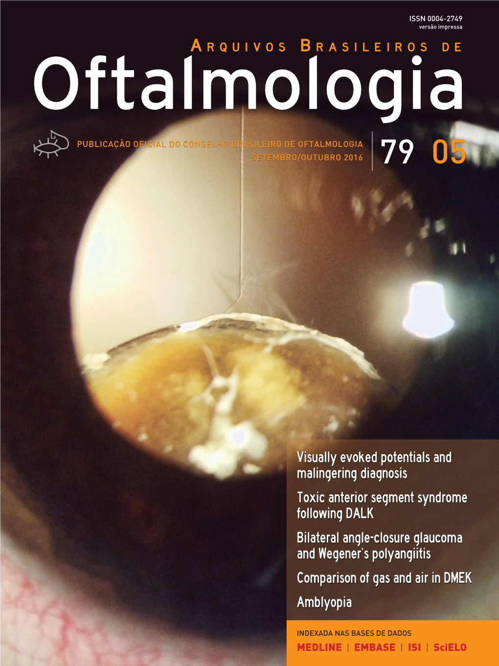 Visually Evoked Potentials and Malingering Diagnosis Toxic