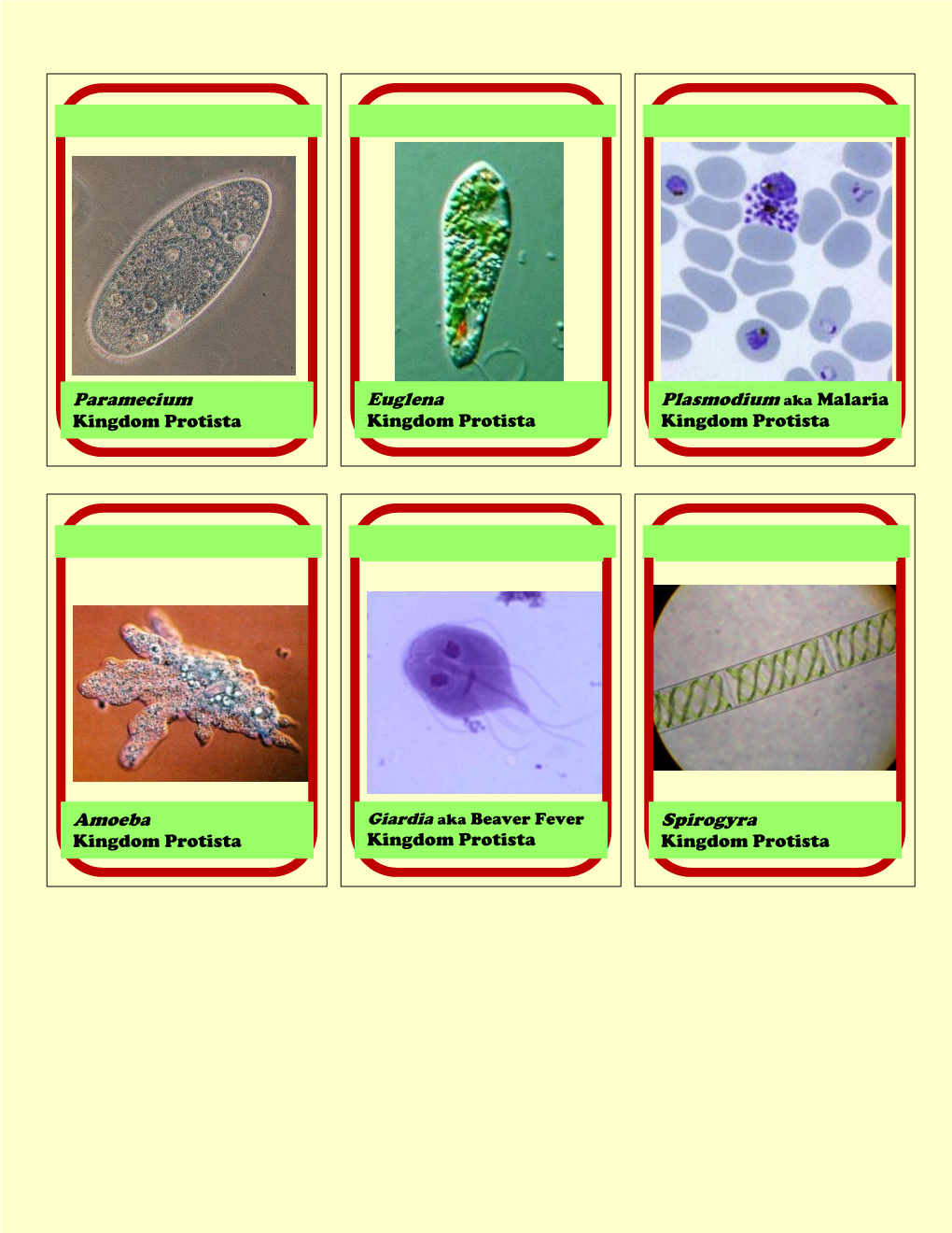 Paramecium Kingdom Protista Euglena Kingdom Protista