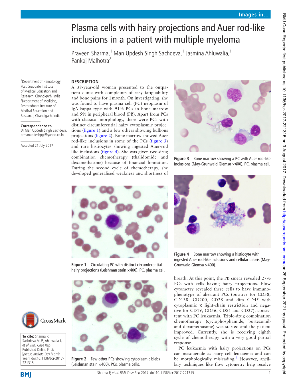 Plasma Cells with Hairy Projections and Auer Rod-Like Inclusions in A