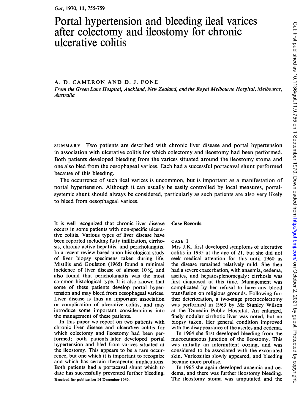 Portal Hypertension and Bleeding Ileal Varices Ulcerative Colitis