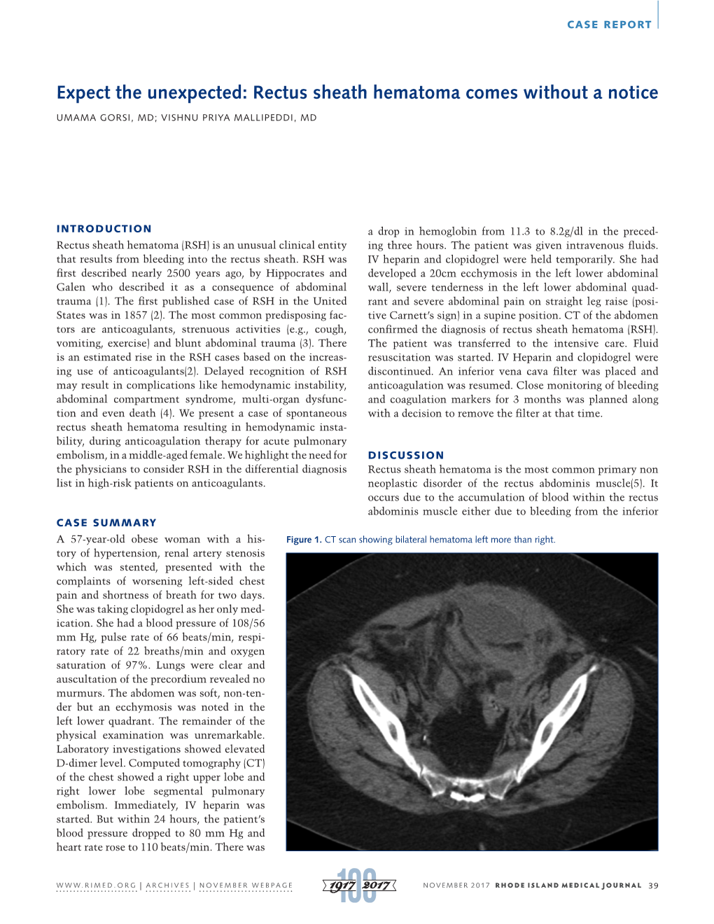 Expect the Unexpected: Rectus Sheath Hematoma Comes Without a Notice