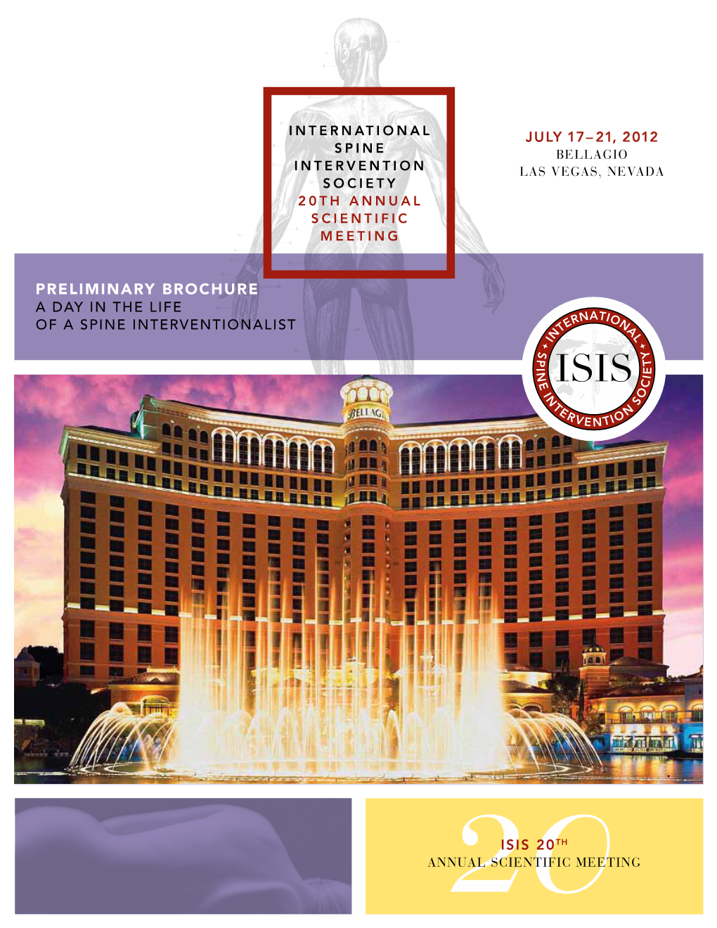Preliminary Brochure a Day in the Life of a Spine Interventionalist Isis