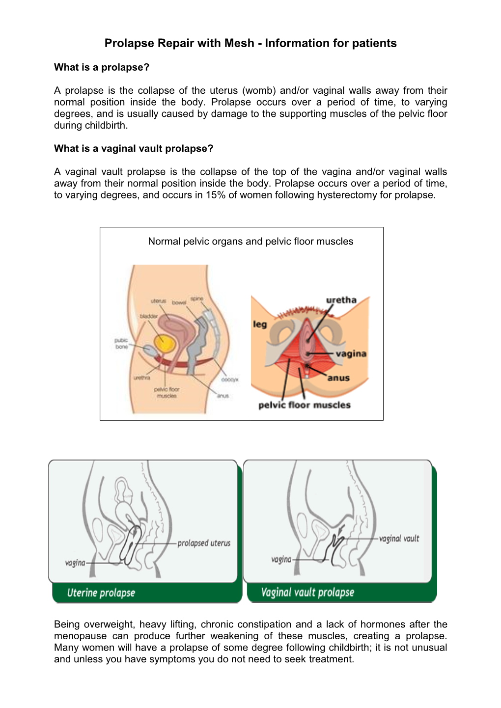 Prolapse and Sacrohysteropexy