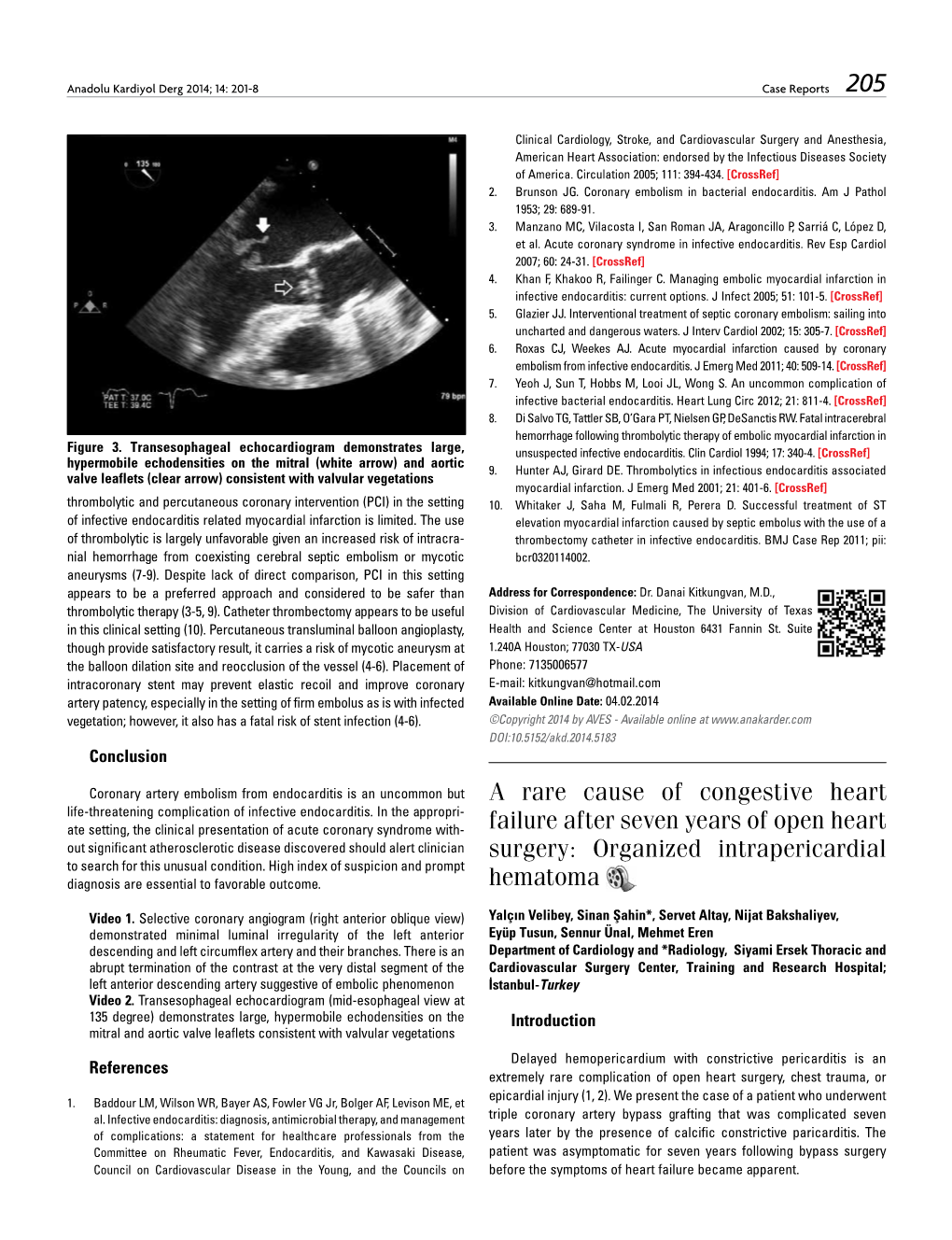 A Rare Cause of Congestive Heart Failure After Seven Years of Open