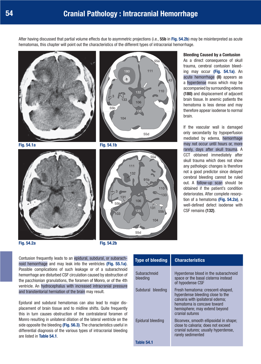 54 Cranial Pathology : Intracranial Hemorrhage