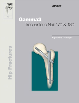 Gamma3 Trochanteric Nail 170 &180 Operative Technique Operative Trochanteric Nail 170 & 180