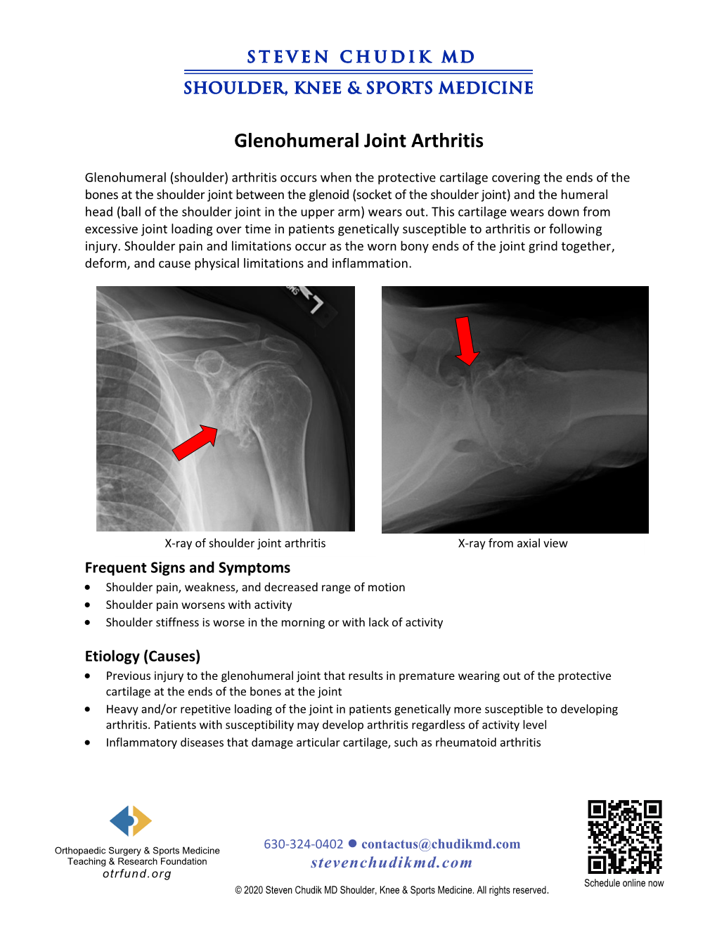 Glenohumeral Shoulder Joint Arthritis - DocsLib