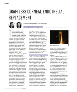 Graftless Corneal Endothelial Replacement