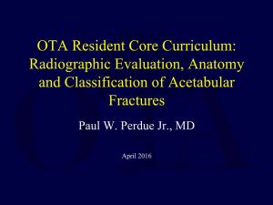Radiographic Evaluation, Anatomy and Classification of Acetabular Fractures Paul W