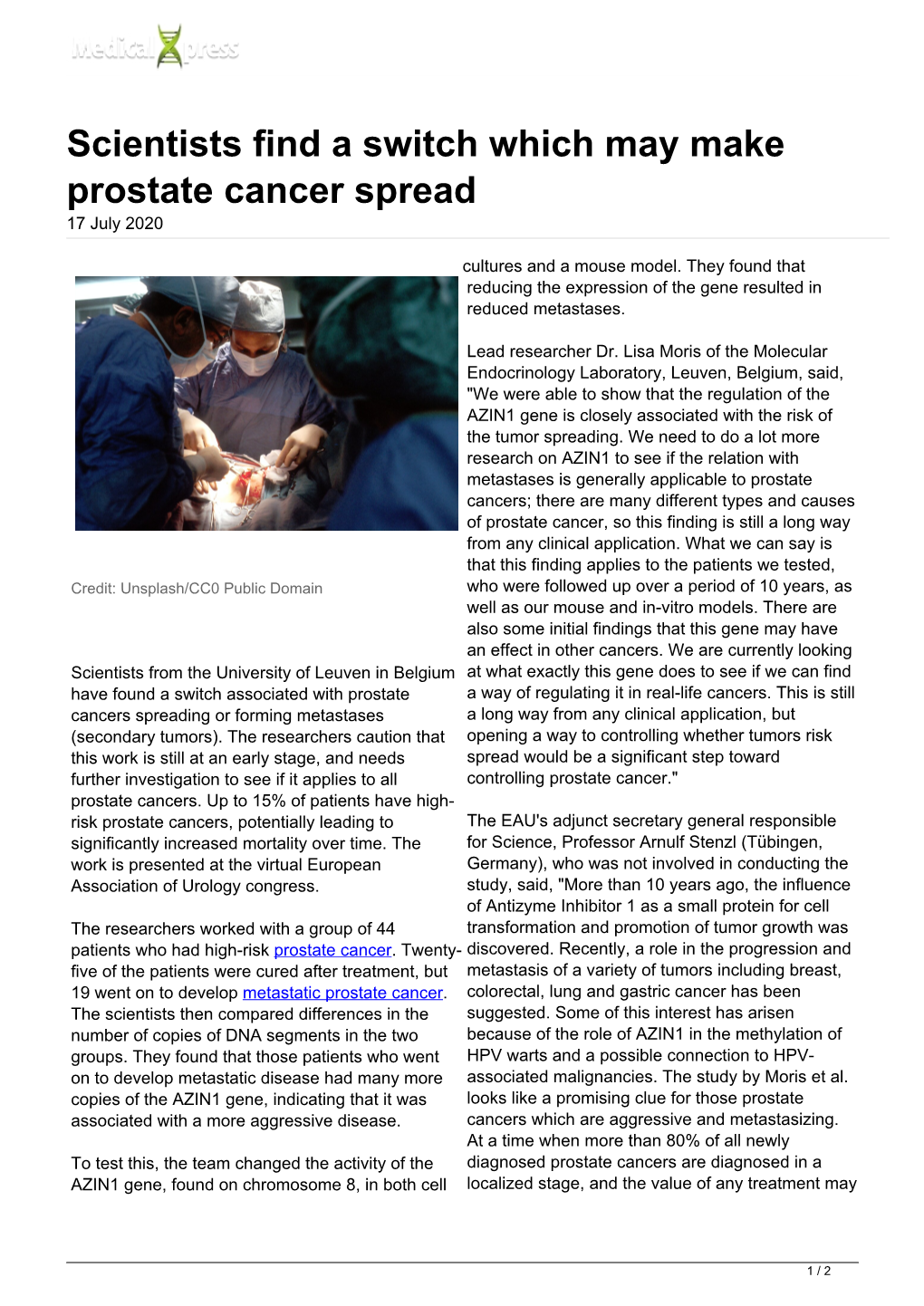 Scientists Find a Switch Which May Make Prostate Cancer Spread 17 July 2020