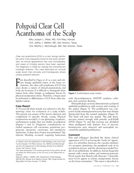 Polypoid Clear Cell Acanthoma of the Scalp MAJ Joseph L