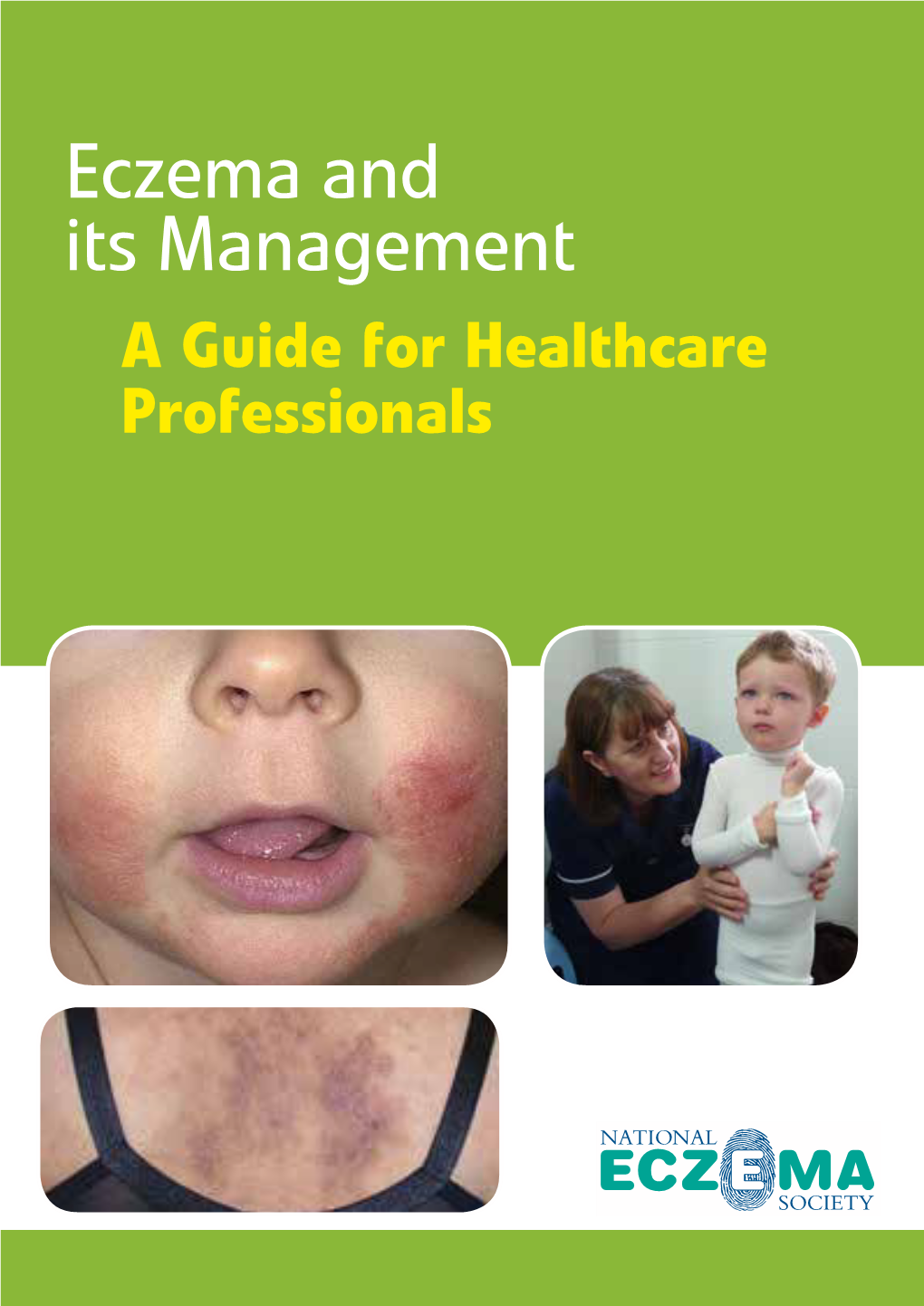 Eczema and Its Management a Guide for Healthcare Professionals CONTENTS PAGE Contents