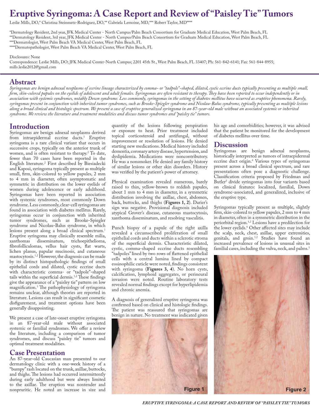 Eruptive Syringoma: a Case Report and Review of “Paisley Tie” - DocsLib