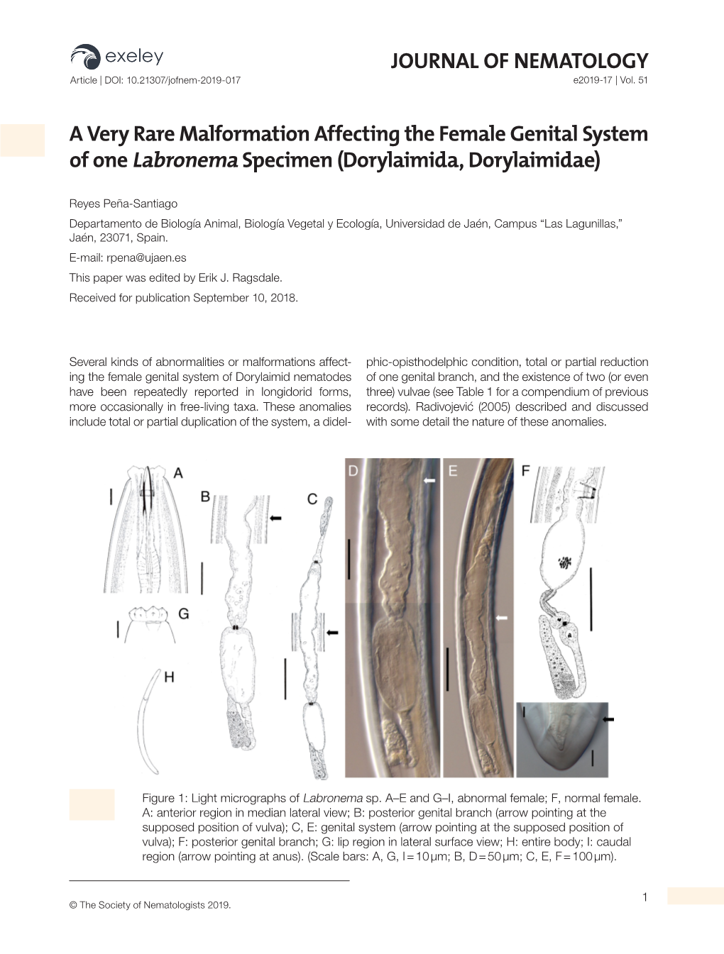 A Very Rare Malformation Affecting the Female Genital System of One Labronema Specimen (Dorylaimida, Dorylaimidae)