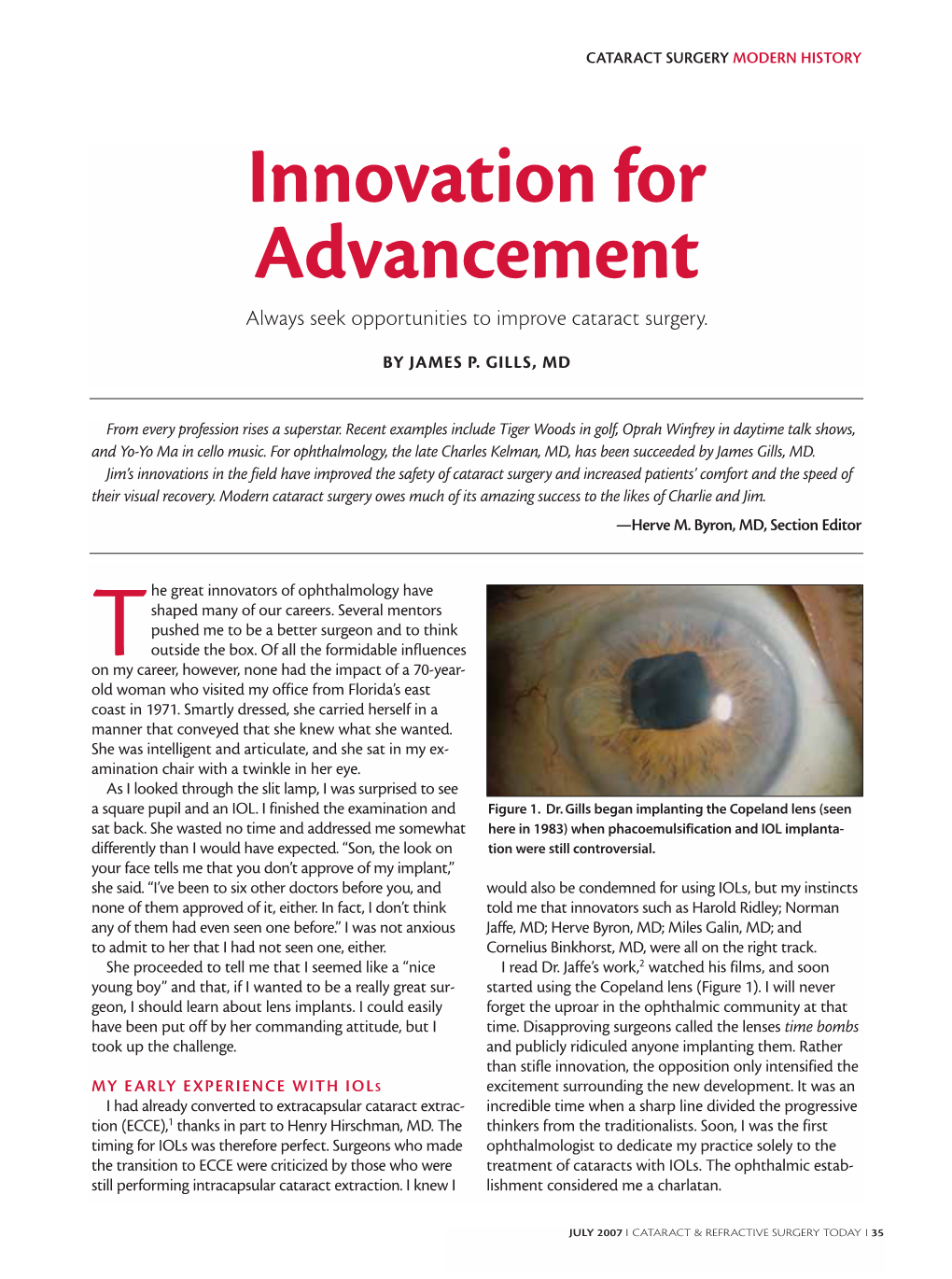 Innovation for Advancement Always Seek Opportunities to Improve Cataract Surgery
