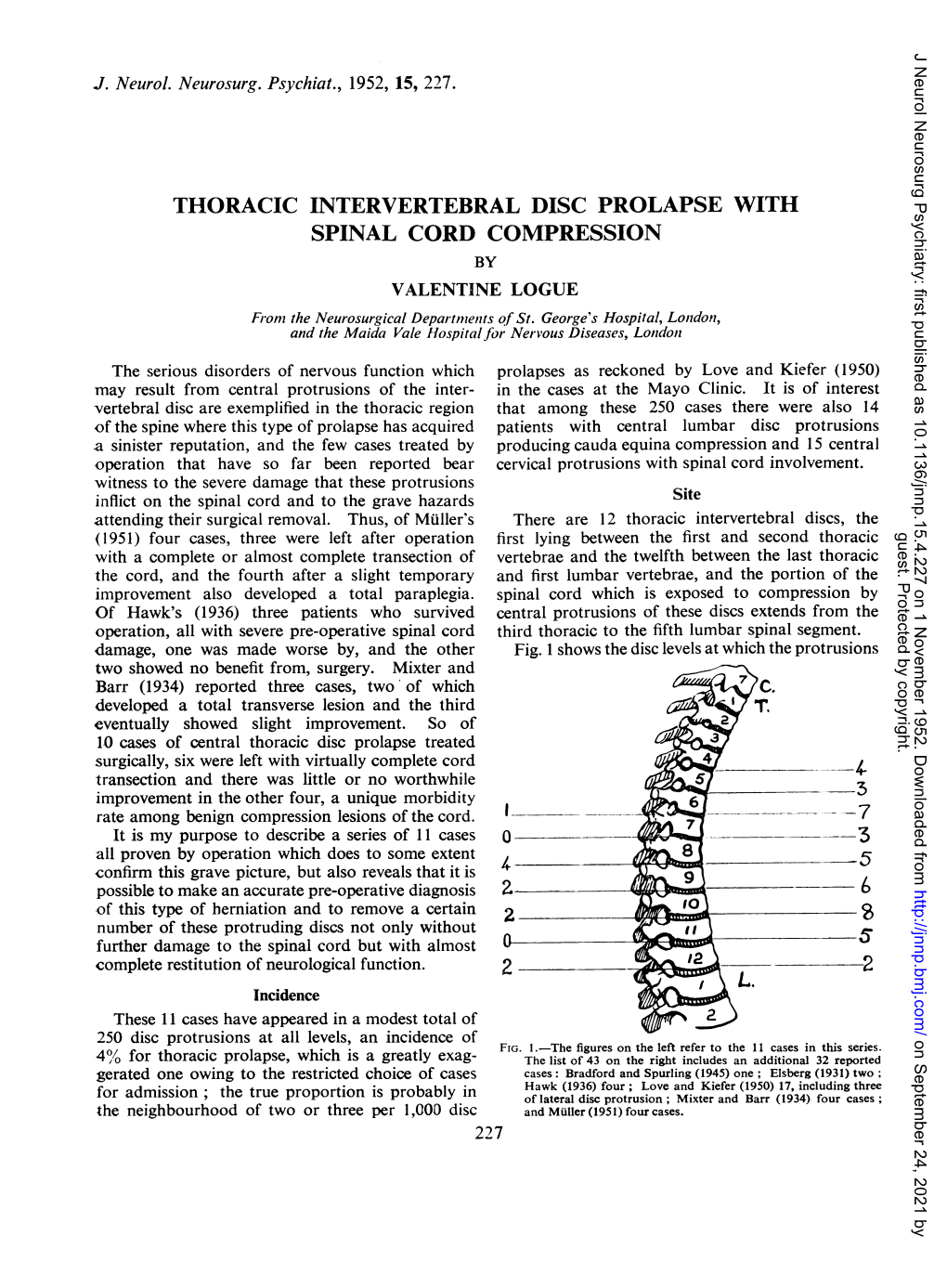 SPINAL CORD COMPRESSION by VALENTINE LOGUE Fronm the Neurosurgical Departments of St