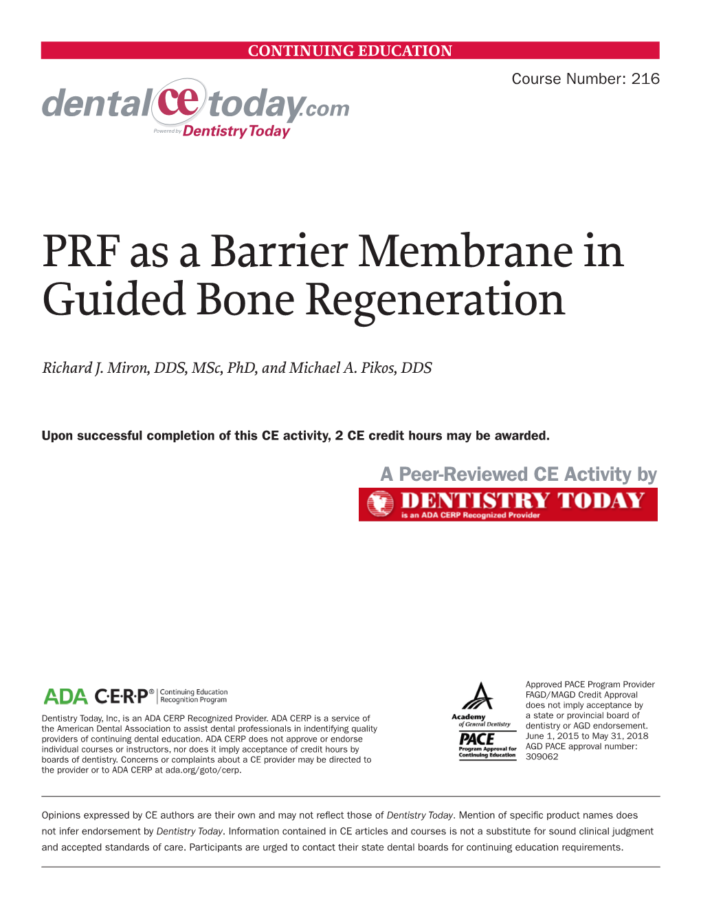 PRF As a Barrier Membrane in Guided Bone Regeneration