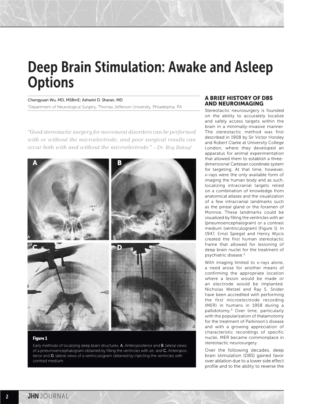 Deep Brain Stimulation: Awake and Asleep Options