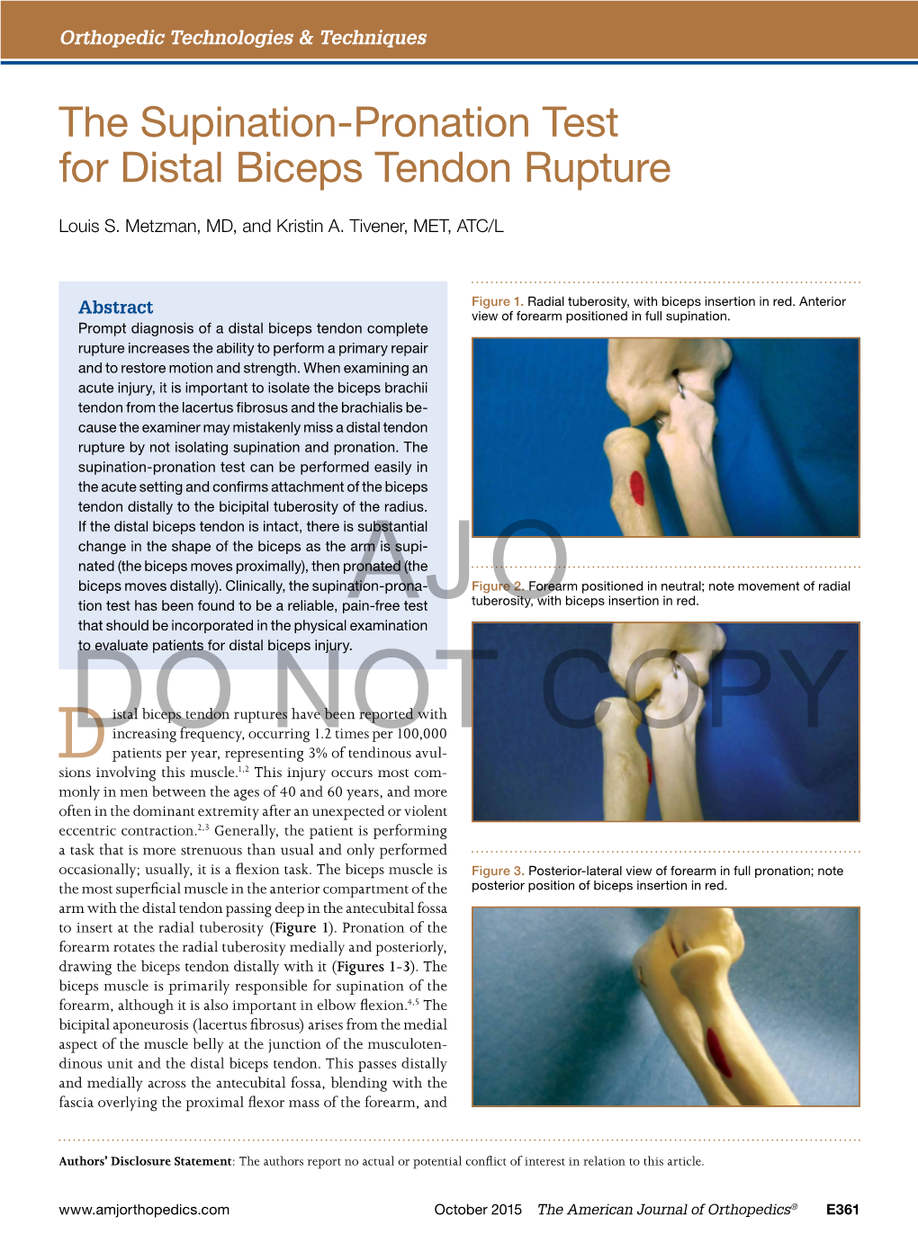 The Supination-Pronation Test for Distal Biceps Tendon Rupture