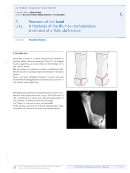 II Fractures of the Thumb — Nonoperative Treatment of a Rolando Fracture