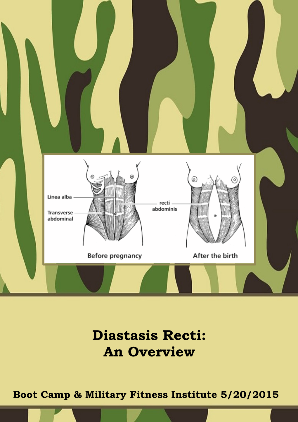 Diastasis Recti: an Overview