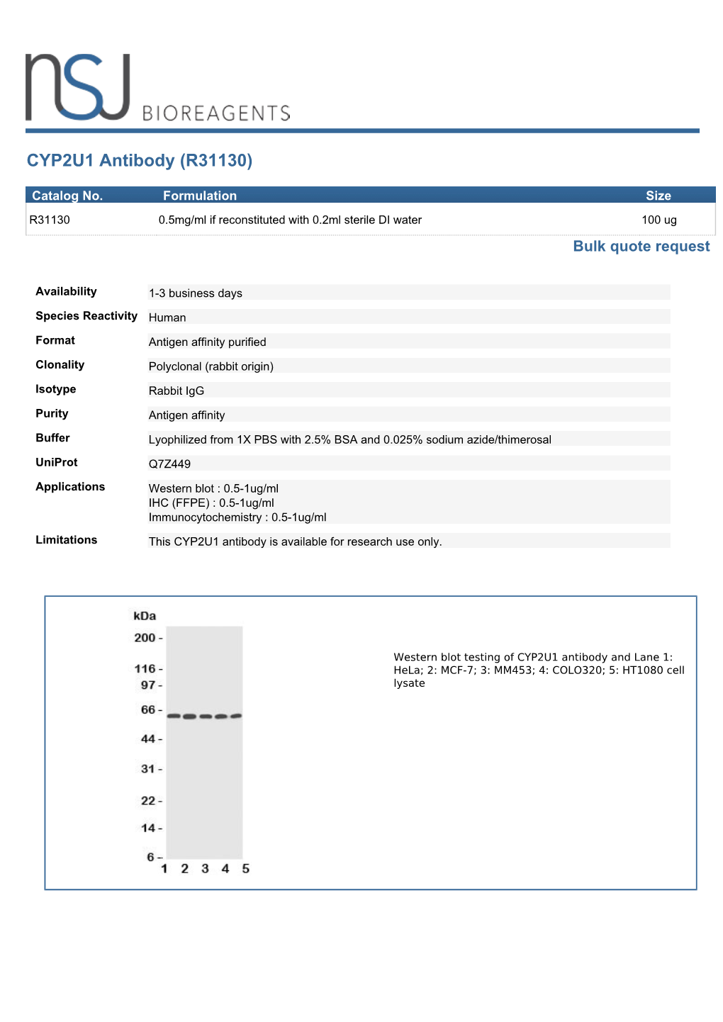 CYP2U1 Antibody (R31130)