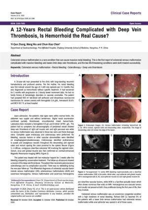 A 12-Years Rectal Bleeding Complicated with Deep Vein Thrombosis, Is Hemorrhoid the Real Cause?