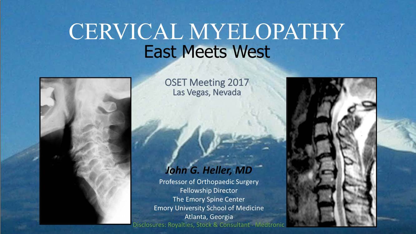 CERVICAL MYELOPATHY East Meets West