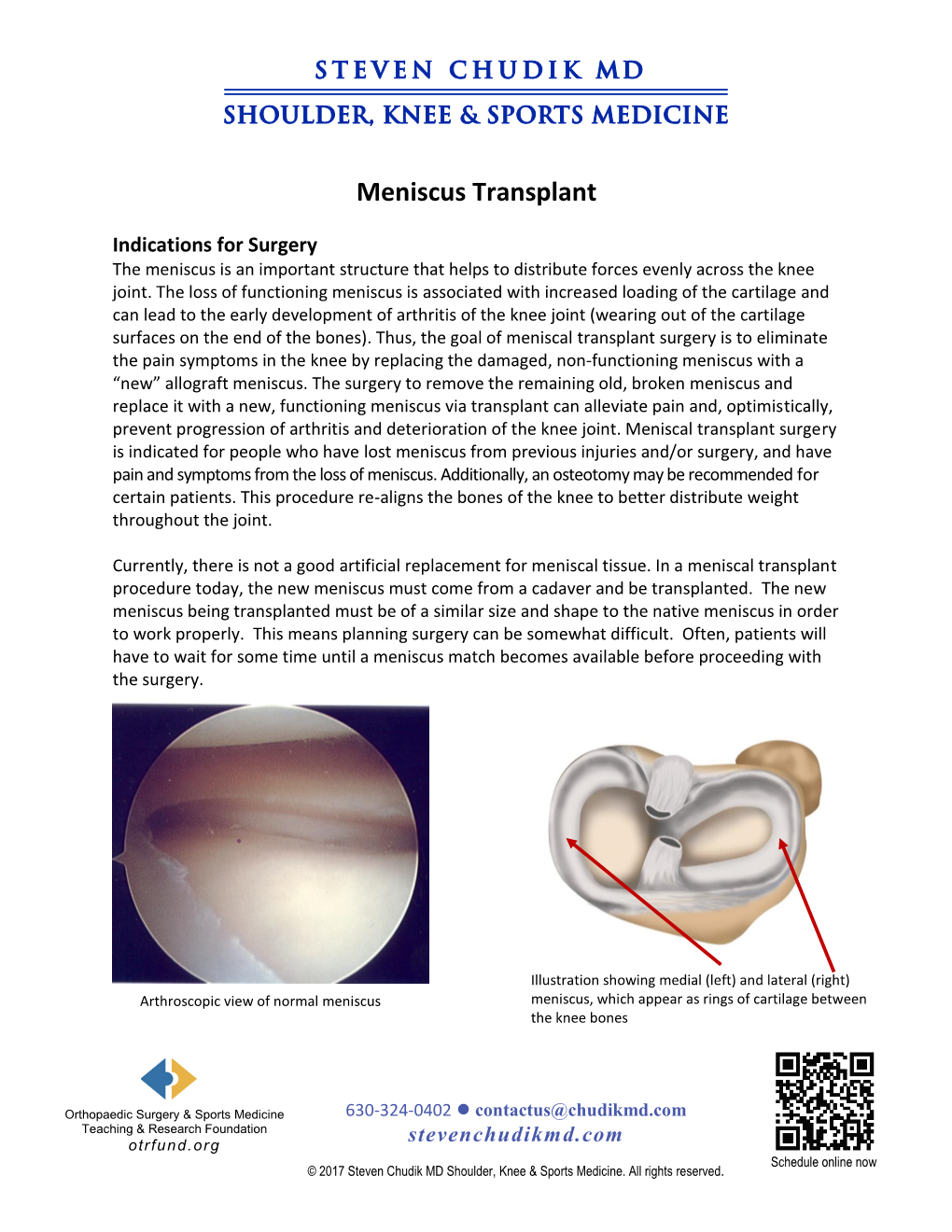 Meniscus Transplant