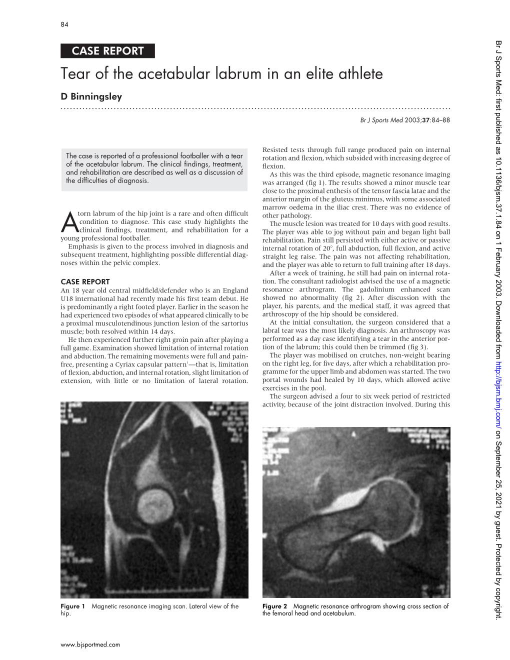 Tear of the Acetabular Labrum in an Elite Athlete D Binningsley