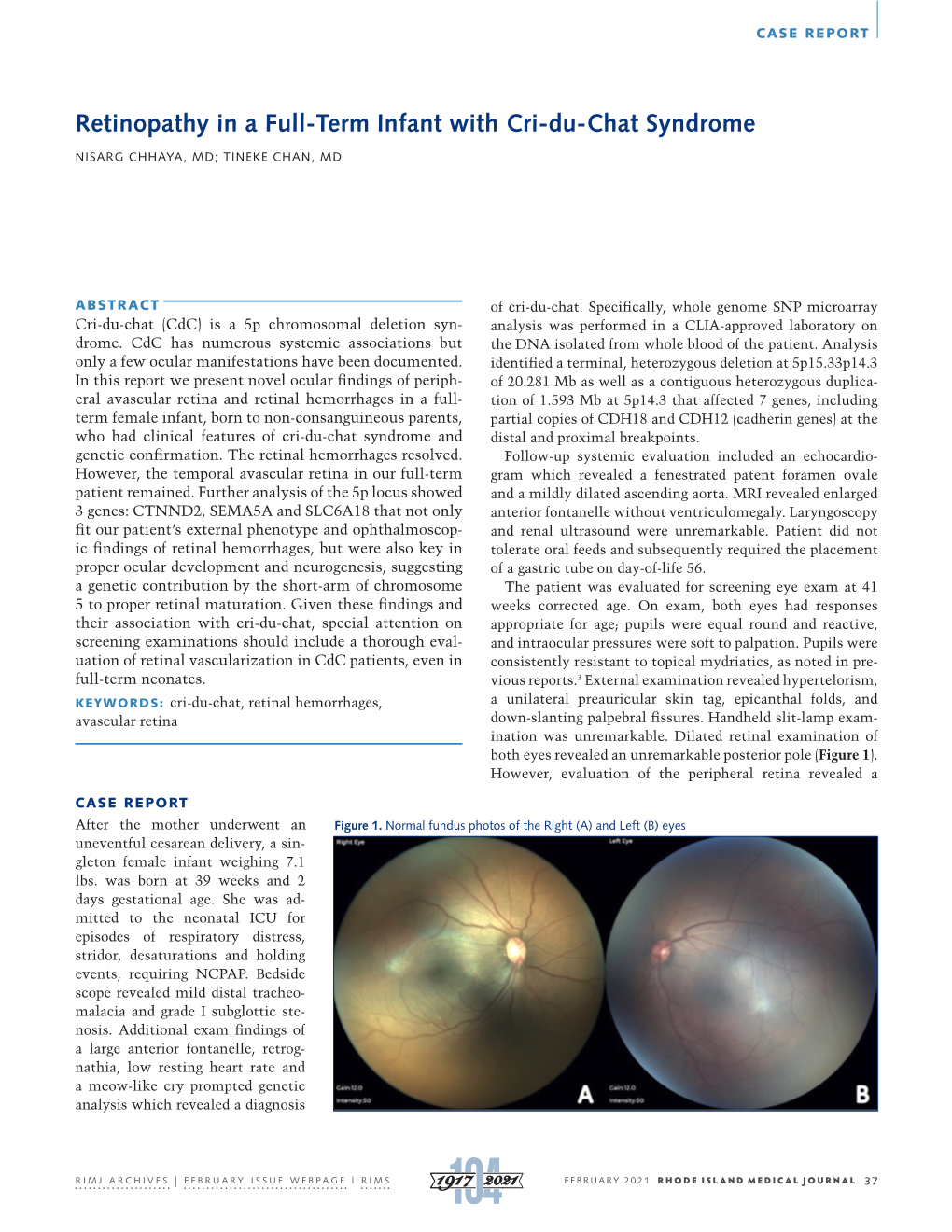 Retinopathy in a Full-Term Infant with Cri-Du-Chat Syndrome